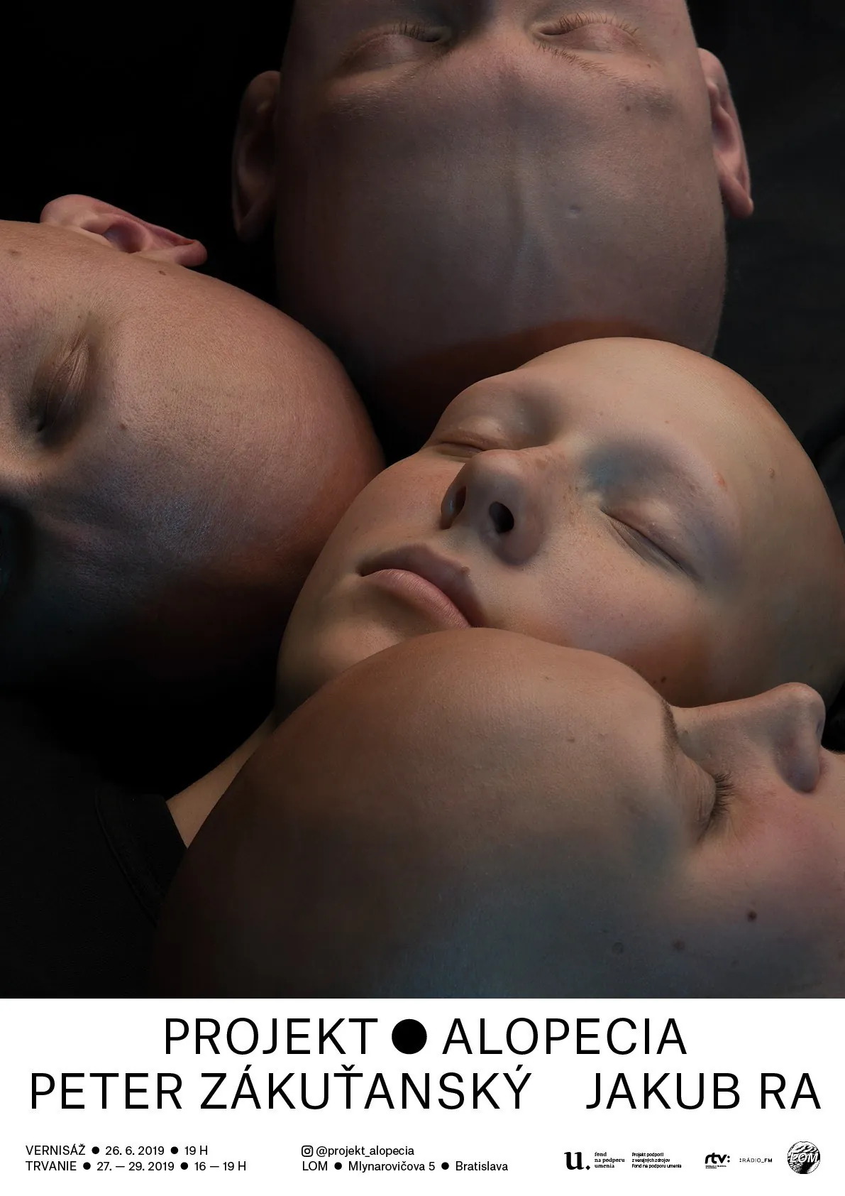 Projekt: Alopecia poster